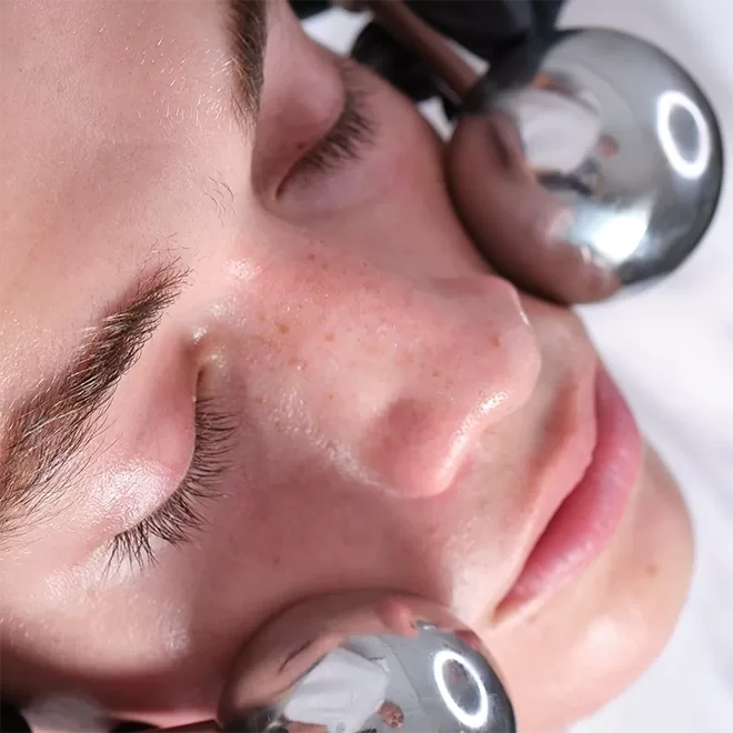 A close-up of a person with closed eyes receiving a facial treatment. Two metallic, rounded instruments are applied to either side of their face, suggesting a calming or rejuvenating procedure.