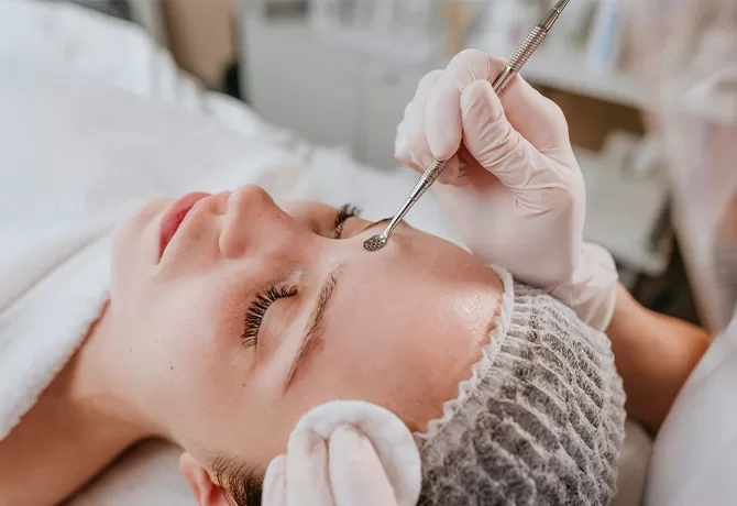 A person is lying on a treatment bed, wearing a hair net. A gloved professional is using a metal tool on their forehead during a skincare procedure. A cotton pad is placed on the side of the persons face.