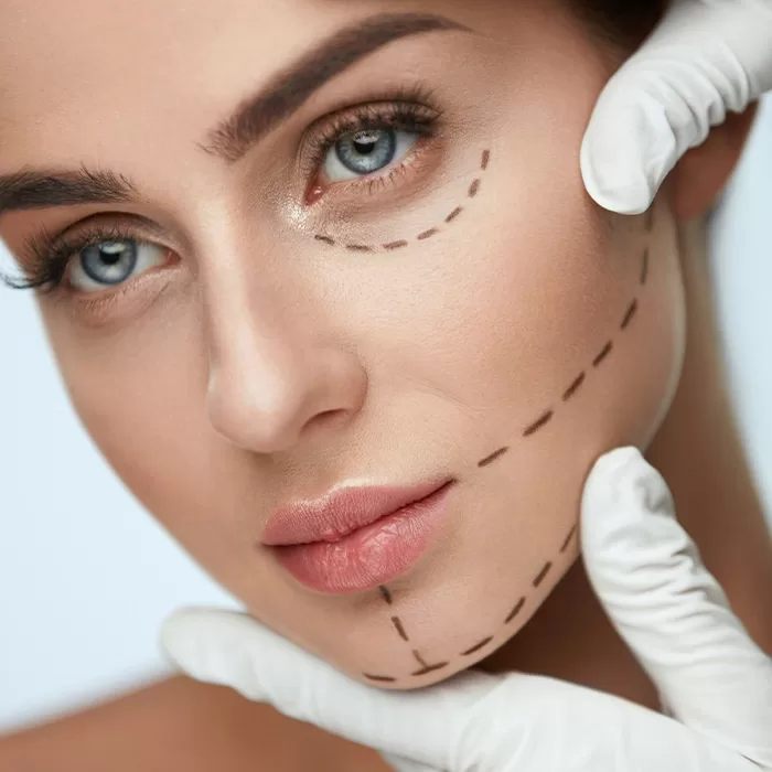 A close-up of a womans face with dotted lines drawn under her eye and along her cheek, suggesting areas for cosmetic surgery. Gloved hands gently touch her chin and temple.